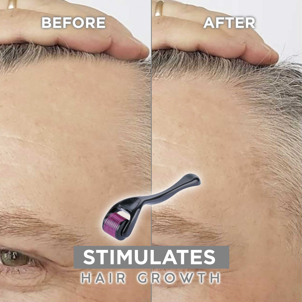 Hair Boosting Device