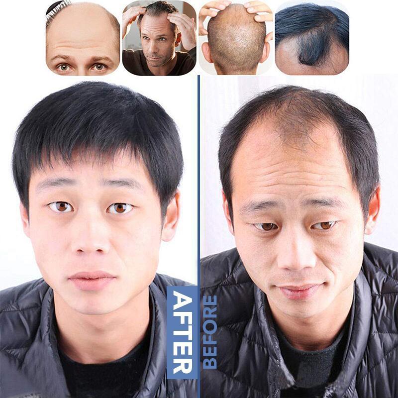 Unisex Seamless Hair Topper