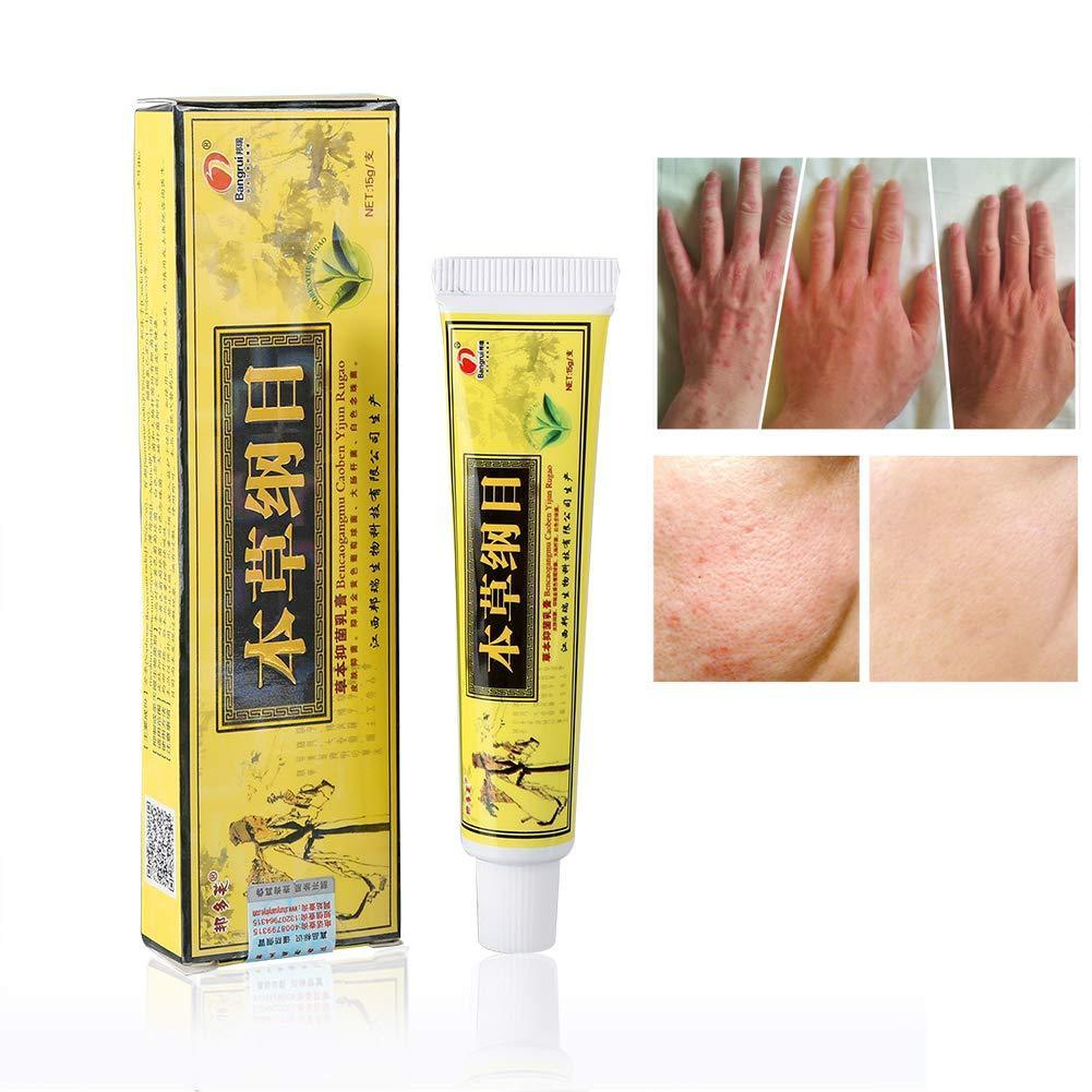 Psoriasis Natural Herbal Cream