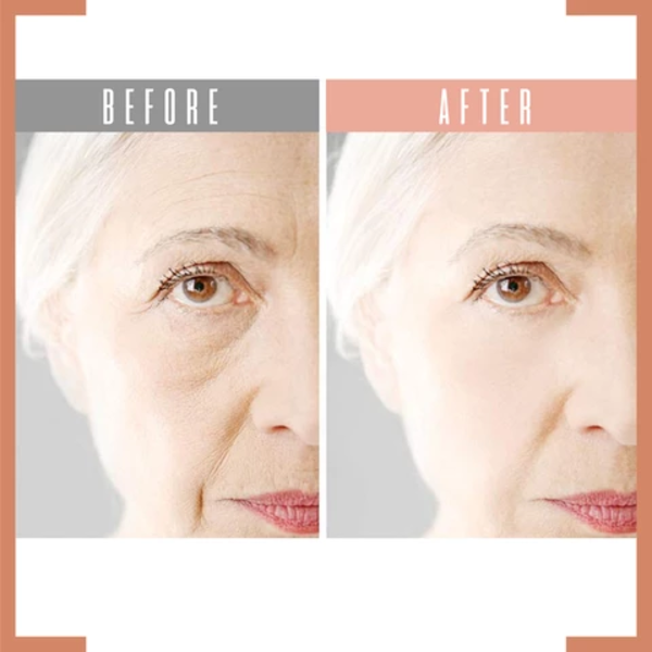 Eye Delight Boost Serum