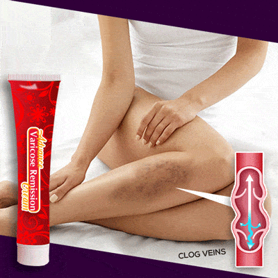 Advanced Varicose Remission Cream