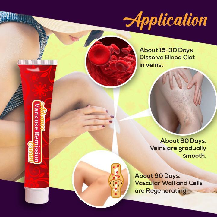 Advanced Varicose Remission Cream