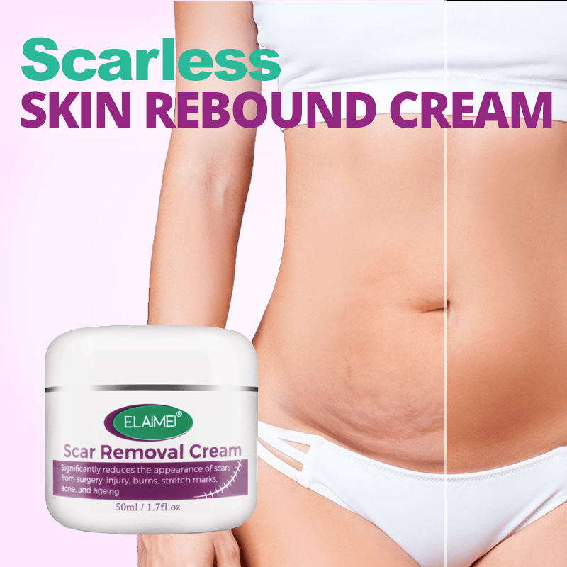 FlawLess Marks Removal Cream
