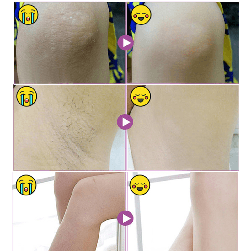 Potent Moisturising And Whitening Cream