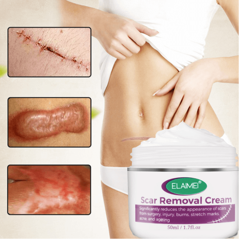 FlawLess Marks Removal Cream