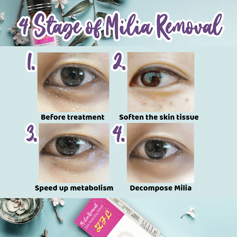M-ilia Removal Skin Perfecting Extract