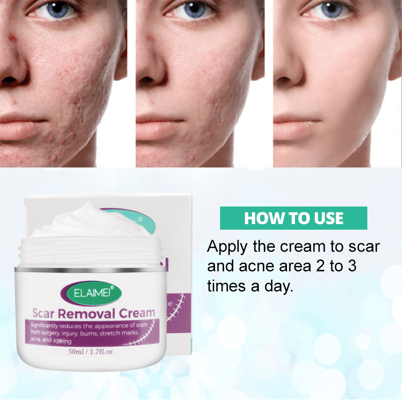 Scarless Skin Rebound Cream