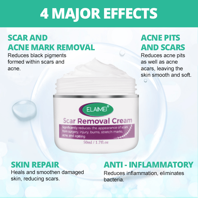 FlawLess Marks Removal Cream