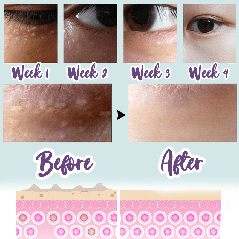 M-ilia Removal Skin Perfecting Extract