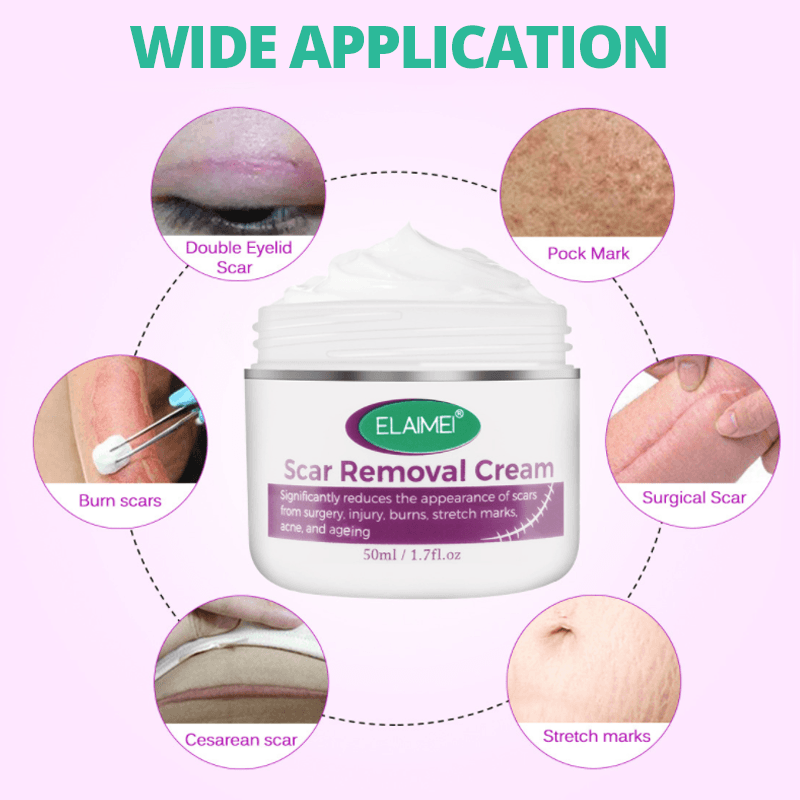 FlawLess Marks Removal Cream