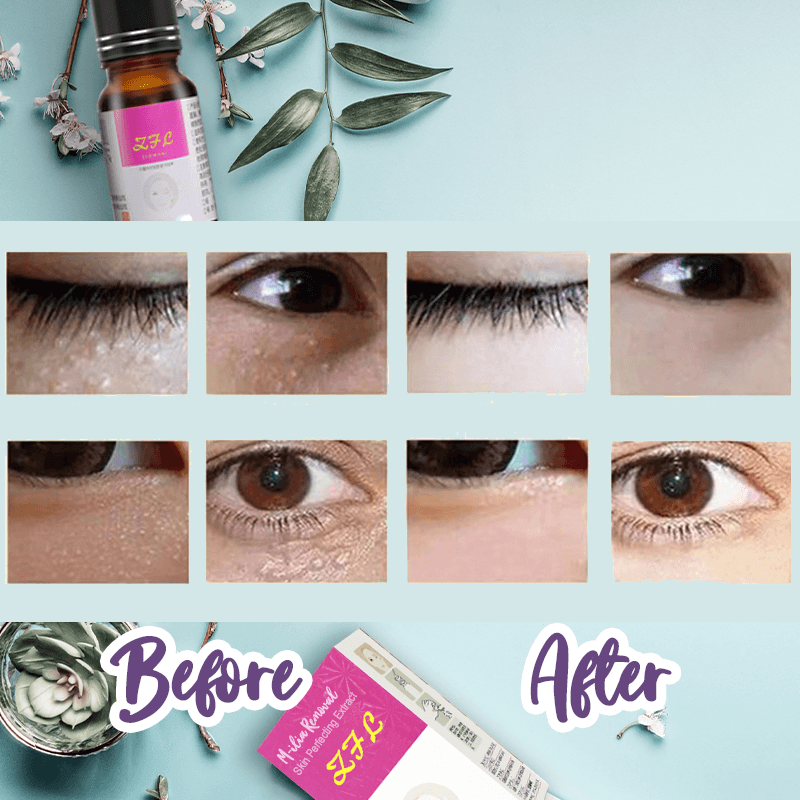 M-ilia Removal Skin Perfecting Extract