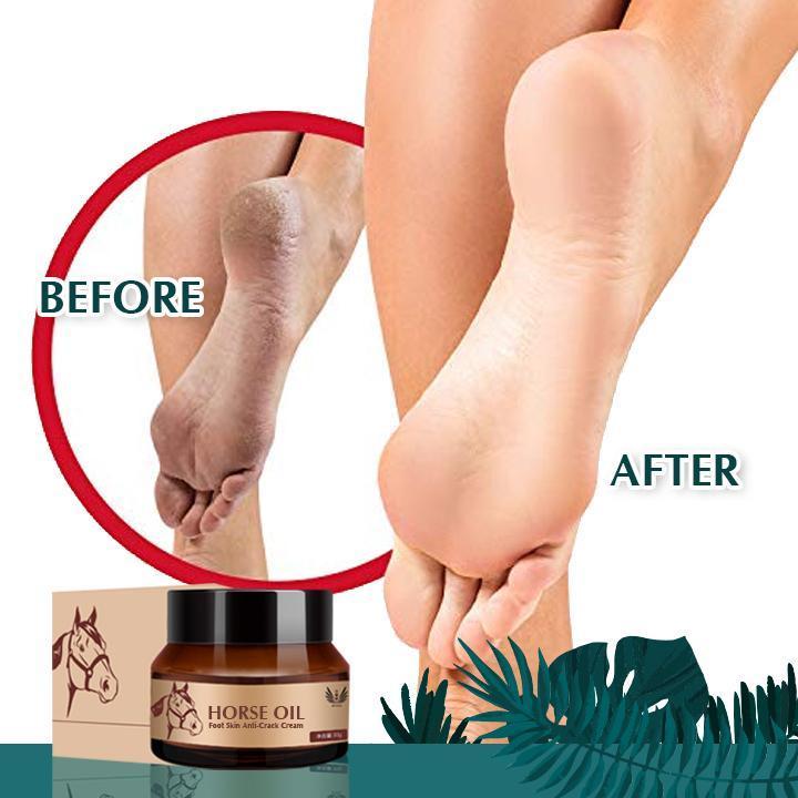 Foot Repair Horse Oil