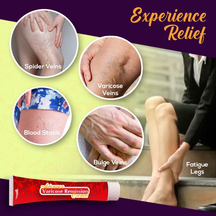 Advanced Varicose Remission Cream