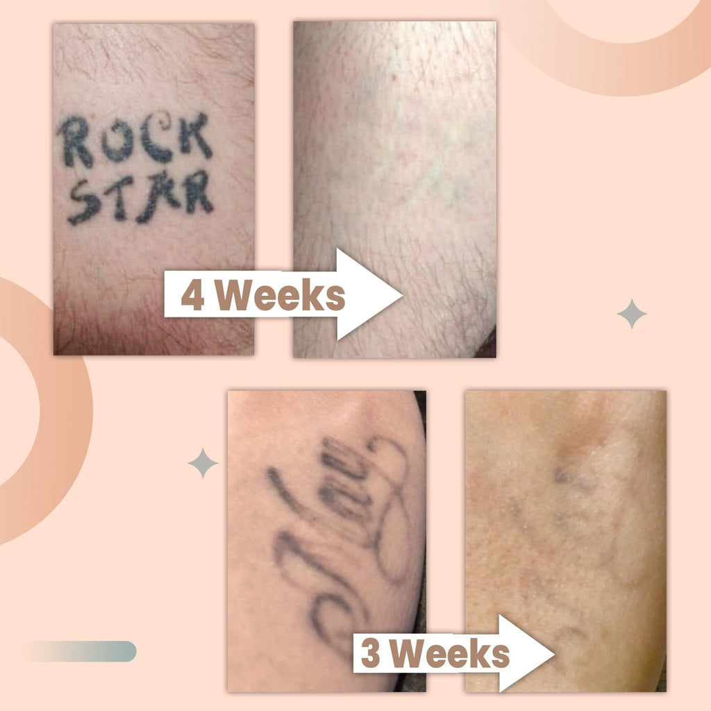 TatOFF 4 Weeks Tattoo Removal Cream
