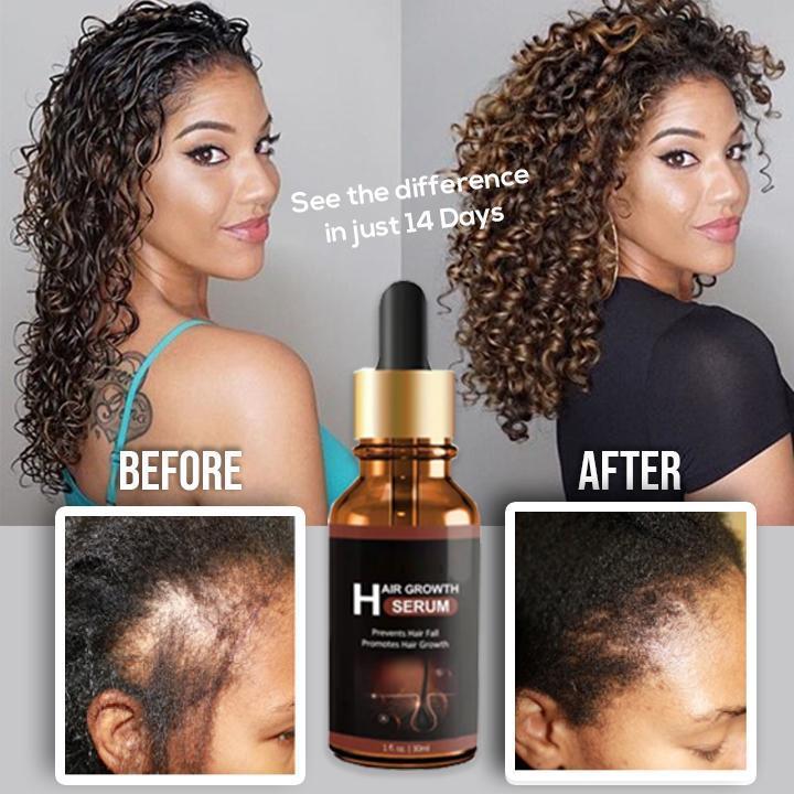 Hair Reboot Treatment