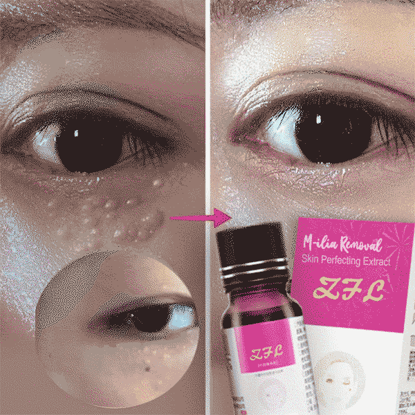 M-ilia Removal Skin Perfecting Extract