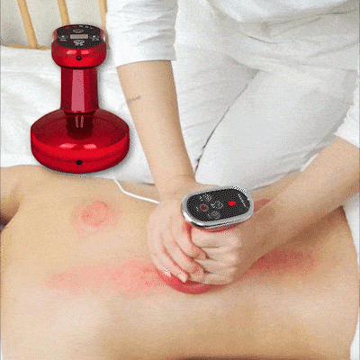 Electric Scraping Massager